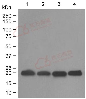 Anti-DUSP3 antibody [EPR5492]  10µl