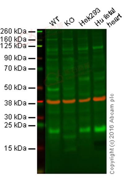 Anti-Ndufs4 antibody [EP7832]  40µl