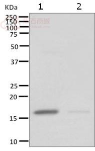 Anti-FXYD6 antibody [EP9005]  40µl