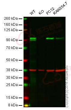 Anti-LSD2 / AOF1 antibody [EPR18508]  40µl