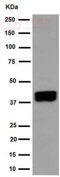 Anti-ART3 antibody [EPR7220(2)] - C-terminal  10µl