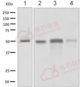 Anti-Factor VII antibody [EP6185(2)]  40µl
