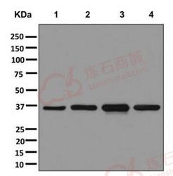 Anti-ARH antibody [EPR13116] - C-terminal  40µl