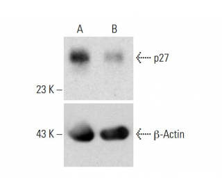 p27 Double Nickase Plasmid (m2)  20 µg