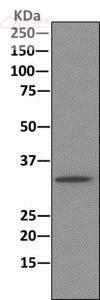 Anti-PPP2CB antibody [EPR11786(B)]  10µl