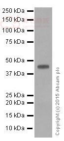 Anti-FNTB antibody [EPR4706]  40µl