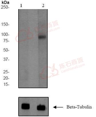 Anti-Ins?lin Receptor (phospho Y1185) antibody [EP351(2)Y]  10µl