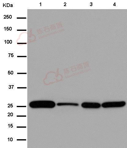 Anti-NDUFS3 antibody [EPR12781]  40µl