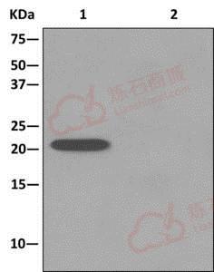 Anti-Artemin antibody [EPR9763]  40µl