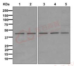 Anti-DHODH antibody [EPR11814]  10µl