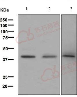 Anti-Blood Group Antigen Precursor antibody [EPR6205]  40µl