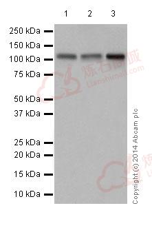 Anti-GRID2 antibody [EPR15422] - N-terminal  100µl