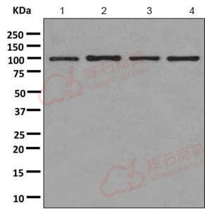 Anti-ABR antibody [EPR7657(2)]  100µl