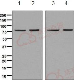 Anti-Methylmalonyl Coenzyme A mutase antibody [EPR7738]  100µl