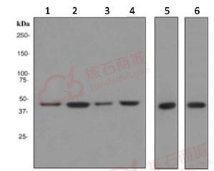Anti-NSE antibody [EPR3378]  100µl
