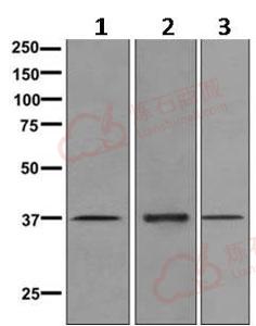 Anti-Kallikrein 5 antibody [EPR9278]  100µl