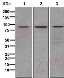 Anti-L3MBTL3 antibody [EPR11854]  10µl