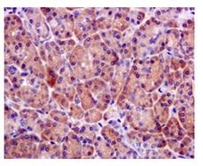 Anti-BRCC45 antibody [EPR11858]  10µl