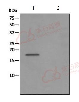 Anti-HSPC014 antibody [EPR10177]  40µl