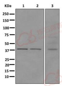 Anti-HPDL antibody [EPR11691] - C-terminal  40µl