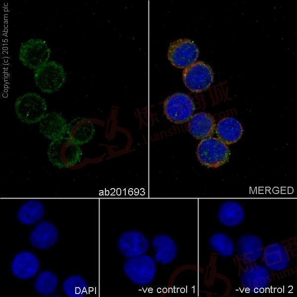Anti-PIGK antibody [EPR17843]  40µl