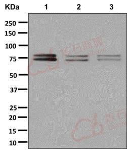 Anti-DDX17 antibody [EPR13807(B)] - C-terminal  100µl