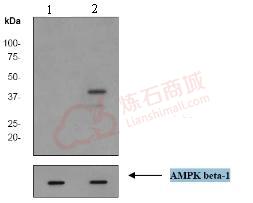 Anti-AMPK beta 1 (phospho S181) antibody [EP2181Y]  100µl