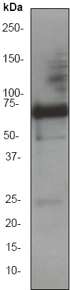 Anti-alpha 1 Fetoprotein antibody [EP1016Y]  10µl