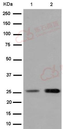 Anti-Prostaglandin dehydrogenase 1 antibody [EPR14332-19]  10µl