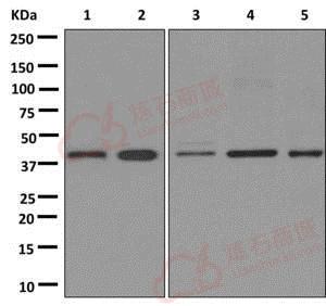 Anti-PAR6 antibody [EPR12378] - N-terminal  100µl