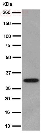 Anti-C10orf63 antibody [EPR14013]  100µl