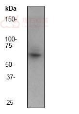 Anti-IRAKM antibody [Y278]  40µl
