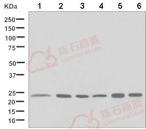 Anti-Adenylate Kinase 1 antibody [EP7083]  10µl
