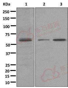 Anti-PPAR delta antibody [EPR5185(2)]  100µl