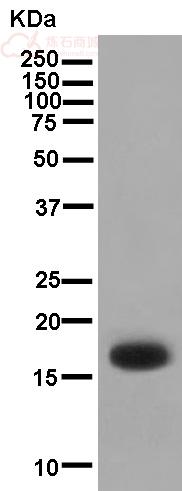 Anti-KRTAP11-1 antibody [EPR13181]  40µl