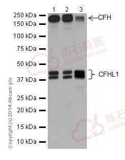 Anti-CFH + CFHL1 antibody [EPR17159]  10µl