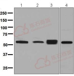 Anti-LACTB antibody [EPR8502]  10µl