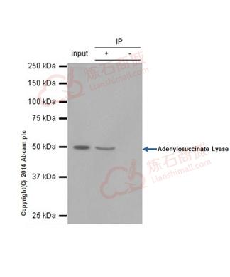 Anti-Adenylosuccinate Lyase antibody [EPR10746(B)]  40µl
