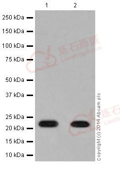 Anti-NDUFB9 antibody [EPR15955-78]  40µl