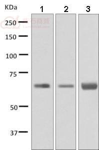 Anti-BTBD17 antibody [EPR9593(B)]  40µl