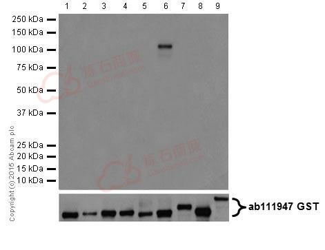 Anti-PKC eta antibody [EPR18513]  100µl