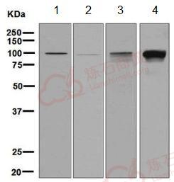 Anti-IFNGR1 antibody [EPR7866]  100µl
