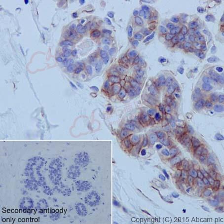 Anti-Integrin alpha 6 antibody [EPR18124]  100µl