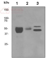 Anti-Fibrinopeptide B antibody [EPR3083]  100µl