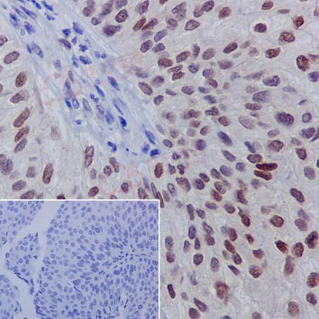Anti-GATA3 (phospho S308) antibody [EPR18118]  10µl