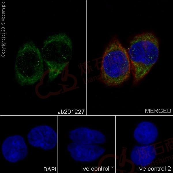 Anti-AP3M1 antibody [EPR16385]  100µl