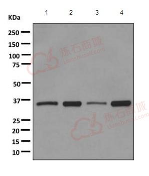 Anti-PPP2CB antibody [EPR11787(B)]  40µl