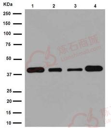 Anti-EIF3S4 antibody [EPR16146] - N-terminal  40µl