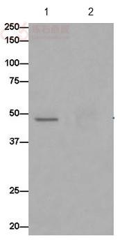 Anti-OVCA1 antibody [EPR15342] - C-terminal  10µl