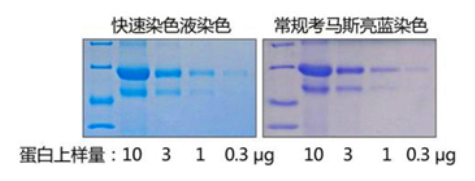 考马斯亮蓝染色试剂盒(常规法)